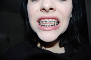 A close-up of a bright, healthy white smile