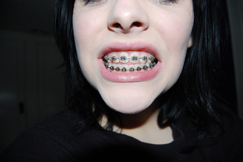 A close-up of a bright, healthy white smile